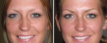 eyebrows-before-after.jpg eyebrows-before-after.jpg